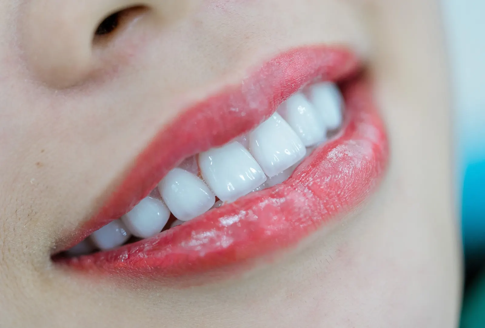 Eating comfortably with restored teeth After